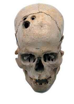 Иллюстрация к книге — История шарлатанства [i_093.jpg]