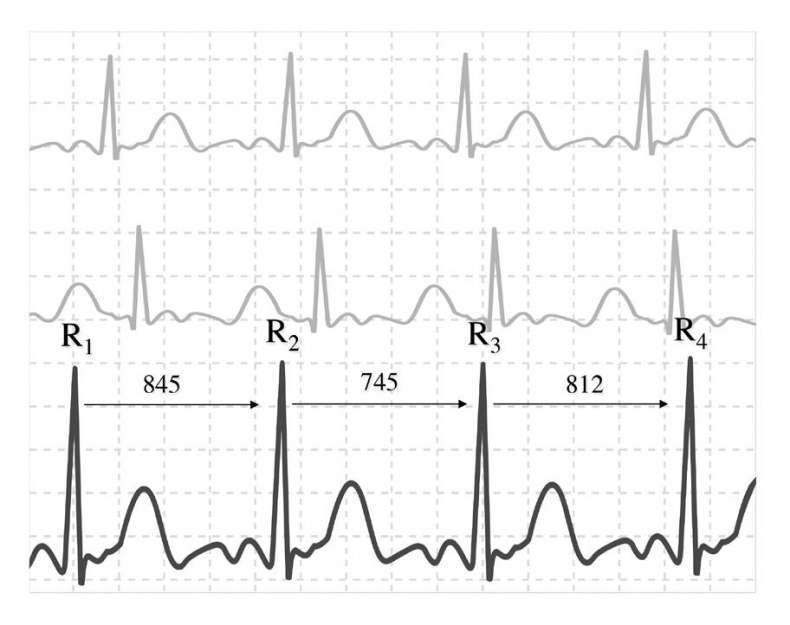 Иллюстрация к книге — Эволюция и подсознание. Как наше прошлое определяет будущее. Человек – дитя вселенной [i_012.jpg]
