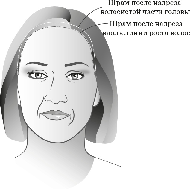 Иллюстрация к книге — Как обмануть возраст [i_025.jpg]