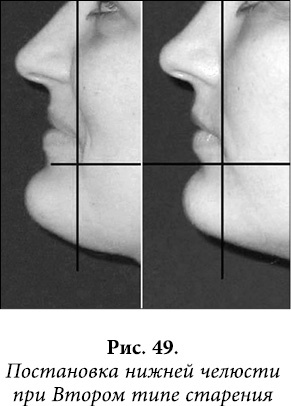 Иллюстрация к книге — Квантовая биомеханика тела. Методика оздоровления опорно-двигательного аппарата человека. Часть 1 [_38.jpg]