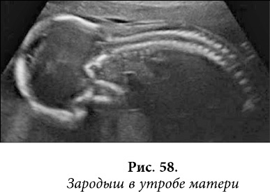 Иллюстрация к книге — Квантовая биомеханика тела. Методика оздоровления опорно-двигательного аппарата человека. Часть 1 [_46.jpg]