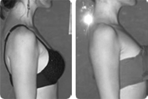 Иллюстрация к книге — Система Осьмионика. Самомоделирование осанки. Коррекция верхней половины тела [_124.jpg]