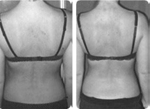 Иллюстрация к книге — Система Осьмионика. Самомоделирование осанки. Коррекция верхней половины тела [_128.jpg]