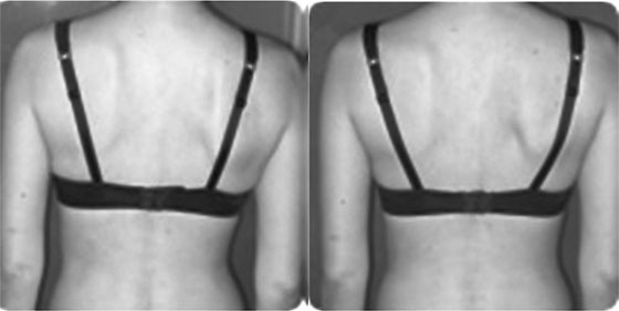 Иллюстрация к книге — Система Осьмионика. Самомоделирование осанки. Коррекция верхней половины тела [_129.jpg]