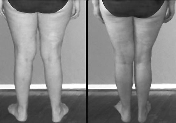 Иллюстрация к книге — Система Осьмионика. Самомоделирование осанки. Коррекция верхней половины тела [_13.jpg]