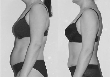 Иллюстрация к книге — Система Осьмионика. Самомоделирование осанки. Коррекция верхней половины тела [_133.jpg]