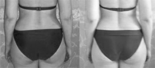 Иллюстрация к книге — Система Осьмионика. Самомоделирование осанки. Коррекция верхней половины тела [_136.jpg]