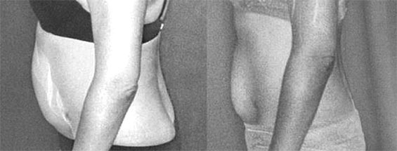 Иллюстрация к книге — Система Осьмионика. Самомоделирование осанки. Коррекция верхней половины тела [_140.jpg]