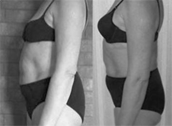 Иллюстрация к книге — Система Осьмионика. Самомоделирование осанки. Коррекция верхней половины тела [_141.jpg]