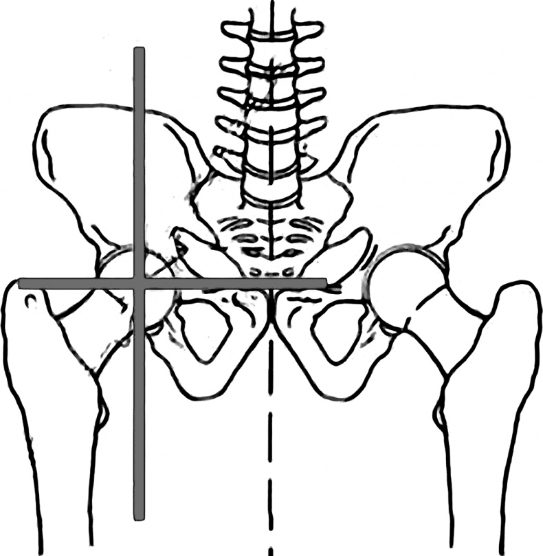 Иллюстрация к книге — Система Осьмионика. Самомоделирование осанки. Коррекция верхней половины тела [_15.jpg]