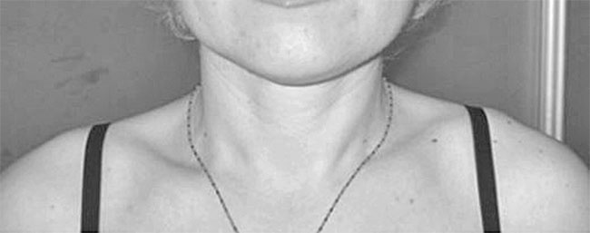 Иллюстрация к книге — Система Осьмионика. Самомоделирование осанки. Коррекция верхней половины тела [_35.jpg]