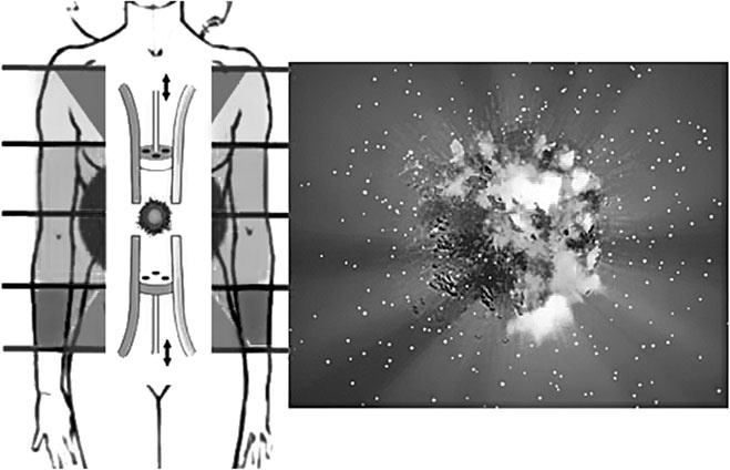 Иллюстрация к книге — Система Осьмионика. Самомоделирование осанки. Коррекция верхней половины тела [_56.jpg]