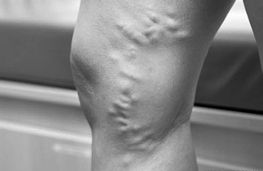 Иллюстрация к книге — Система Осьмионика. Самомоделирование осанки. Коррекция верхней половины тела [_63.jpg]