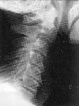 Иллюстрация к книге — Система Осьмионика. Самомоделирование осанки. Коррекция верхней половины тела [_71.jpg]