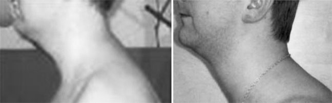 Иллюстрация к книге — Система Осьмионика. Самомоделирование осанки. Коррекция верхней половины тела [_72.jpg]