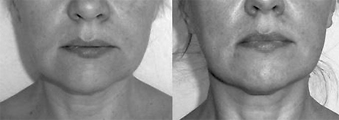 Иллюстрация к книге — Система Осьмионика. Самомоделирование осанки. Коррекция верхней половины тела [_74.jpg]