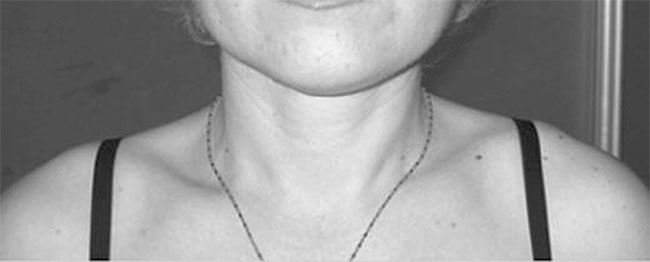 Иллюстрация к книге — Система Осьмионика. Самомоделирование осанки. Коррекция верхней половины тела [_95.jpg]