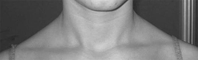 Иллюстрация к книге — Система Осьмионика. Самомоделирование осанки. Коррекция верхней половины тела [_97.jpg]