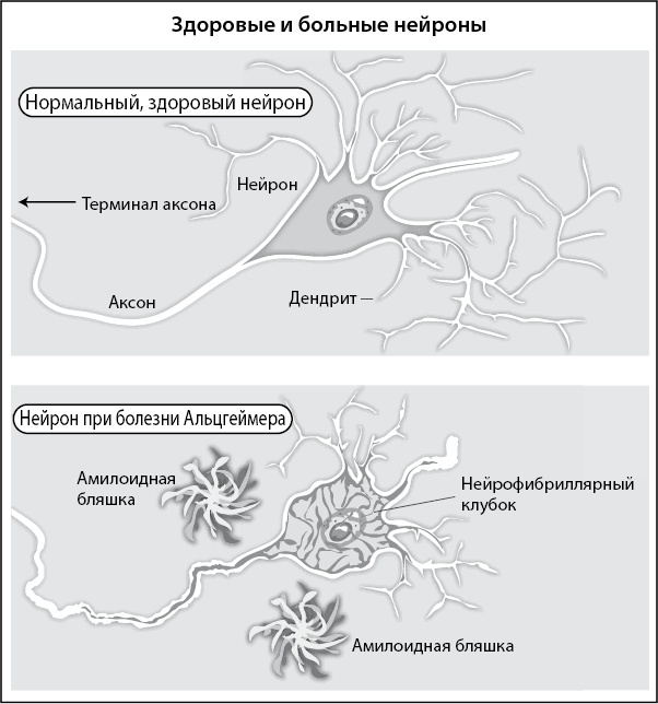 Иллюстрация к книге — Нестареющий мозг [i_006.jpg]