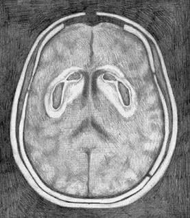 Иллюстрация к книге — Заблокированные нейроны  [i_012.jpg]