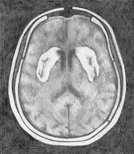 Иллюстрация к книге — Заблокированные нейроны  [i_013.jpg]