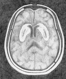 Иллюстрация к книге — Заблокированные нейроны  [i_014.jpg]