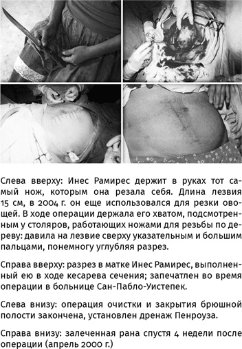 Иллюстрация к книге — 100 рассказов из истории медицины  [i_162.jpg]