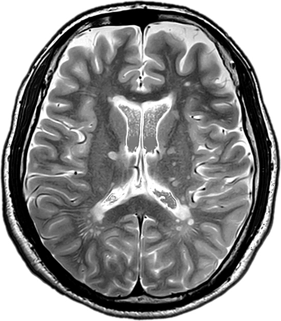 Иллюстрация к книге — Забывчивость - мое второе ... что-то там. Как вернуть то, что постоянно вылетает из головы [i_004.jpg]