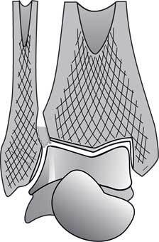 Иллюстрация к книге — Здоровье через стопы  [i_050.jpg]