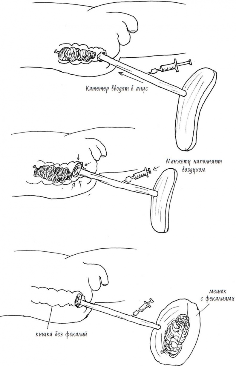 Иллюстрация к книге — Wow, anus! Неожиданные откровения о том самом месте [i_020.jpg]