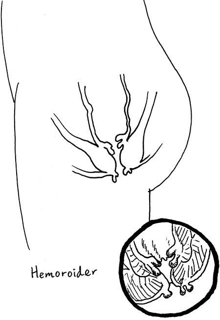 Иллюстрация к книге — Wow, anus! Неожиданные откровения о том самом месте [i_040.jpg]