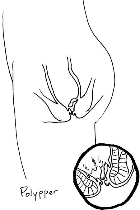 Иллюстрация к книге — Wow, anus! Неожиданные откровения о том самом месте [i_043.jpg]