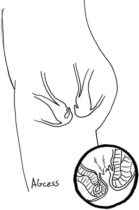 Иллюстрация к книге — Wow, anus! Неожиданные откровения о том самом месте [i_046.jpg]