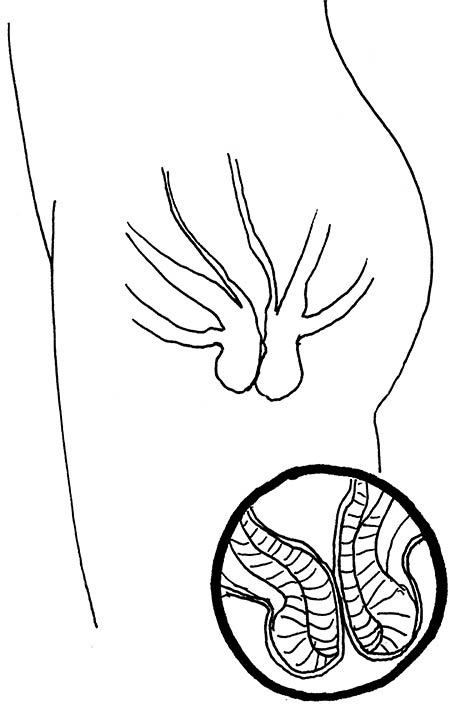 Иллюстрация к книге — Wow, anus! Неожиданные откровения о том самом месте [i_047.jpg]