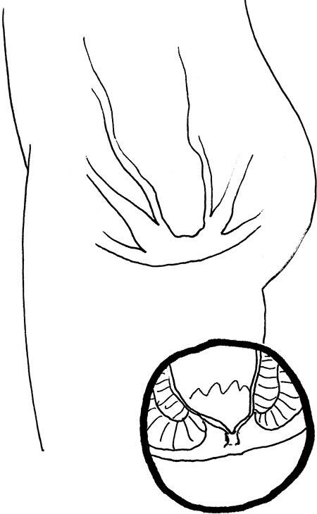 Иллюстрация к книге — Wow, anus! Неожиданные откровения о том самом месте [i_052.jpg]