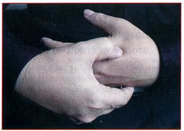 Иллюстрация к книге — Секреты китайских целителей: диагностика и лечение болезней по руке [_04.jpg]