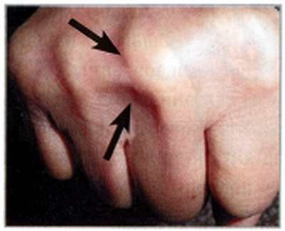 Иллюстрация к книге — Секреты китайских целителей: диагностика и лечение болезней по руке [_06.jpg]