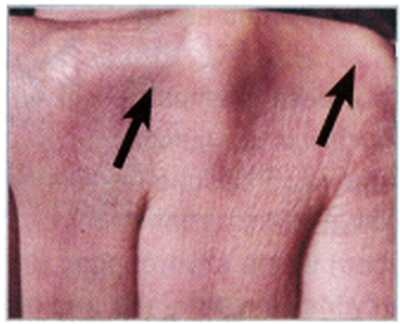 Иллюстрация к книге — Секреты китайских целителей: диагностика и лечение болезней по руке [_07.jpg]