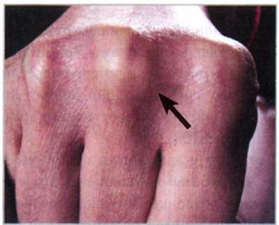 Иллюстрация к книге — Секреты китайских целителей: диагностика и лечение болезней по руке [_08.jpg]