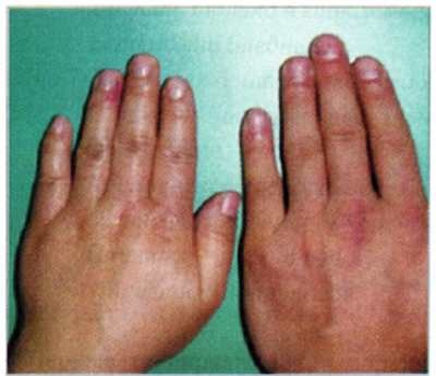 Иллюстрация к книге — Секреты китайских целителей: диагностика и лечение болезней по руке [_10.jpg]