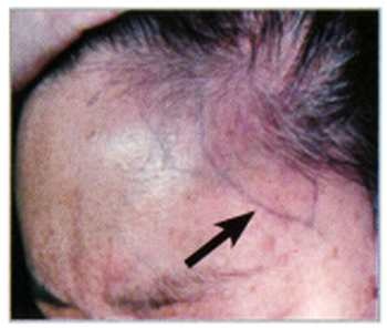 Иллюстрация к книге — Секреты китайских целителей: диагностика и лечение болезней по руке [_19.jpg]