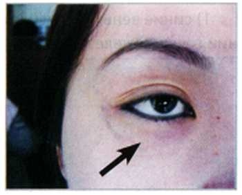 Иллюстрация к книге — Секреты китайских целителей: диагностика и лечение болезней по руке [_21.jpg]