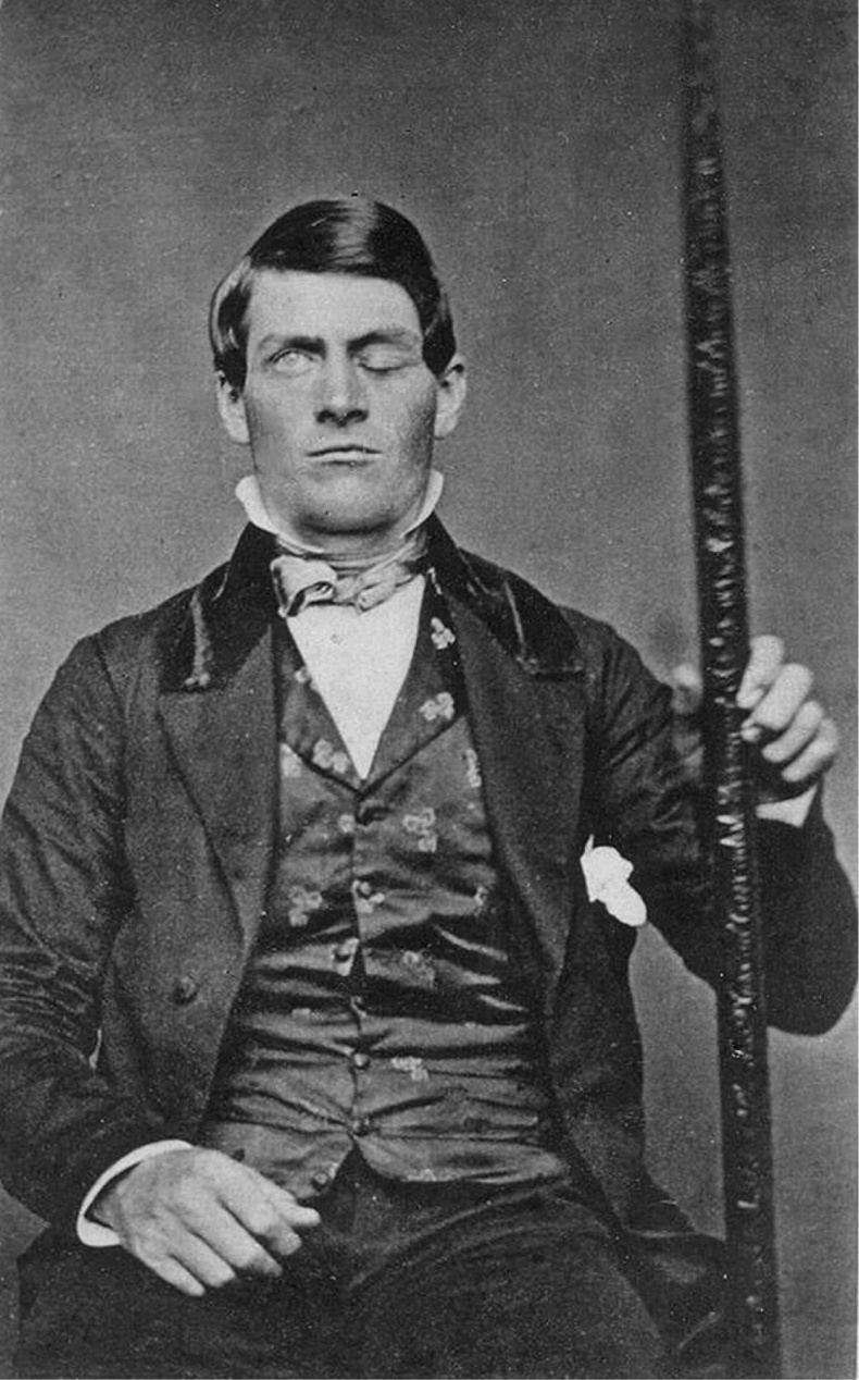 Иллюстрация к книге — Мозговодство  [i_017.jpg]