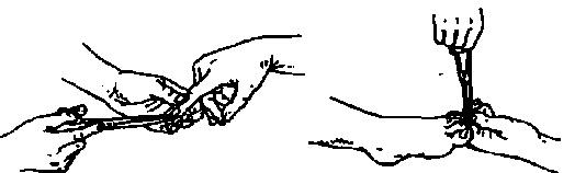 Иллюстрация к книге — Учебник для сестер милосердия  [i_021.jpg]