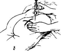 Иллюстрация к книге — Учебник для сестер милосердия  [i_031.jpg]