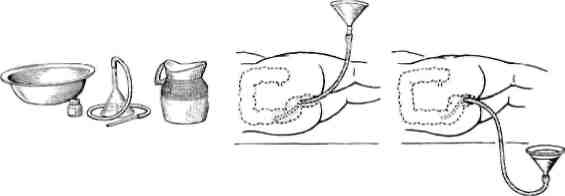 Иллюстрация к книге — Учебник для сестер милосердия  [i_038.jpg]