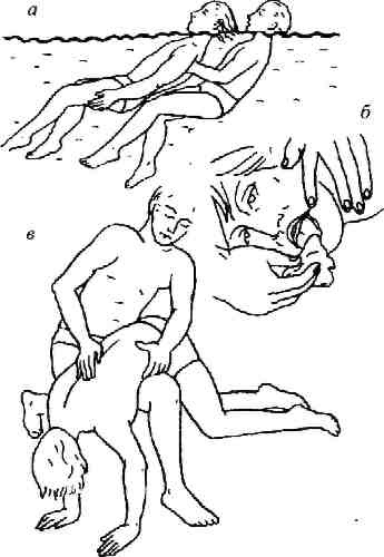 Иллюстрация к книге — Учебник для сестер милосердия  [i_056.jpg]