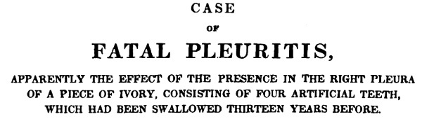 Иллюстрация к книге — Безумная медицина. Странные заболевания и не менее странные методы лечения в истории медицины [i_080.jpg]
