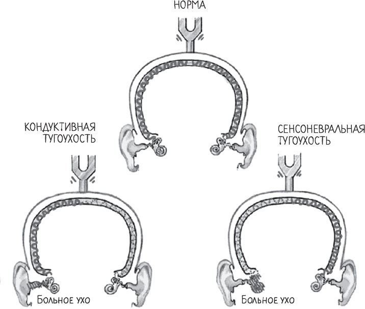 Иллюстрация к книге — В лабиринтах уха, горла и носа. Скрытые механизмы работы, неочевидные взаимосвязи и полезные знания, которые помогут «дотянуть» до визита к врачу [i_011.jpg]
