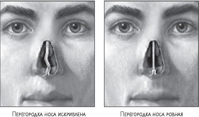 Иллюстрация к книге — В лабиринтах уха, горла и носа. Скрытые механизмы работы, неочевидные взаимосвязи и полезные знания, которые помогут «дотянуть» до визита к врачу [i_023.jpg]